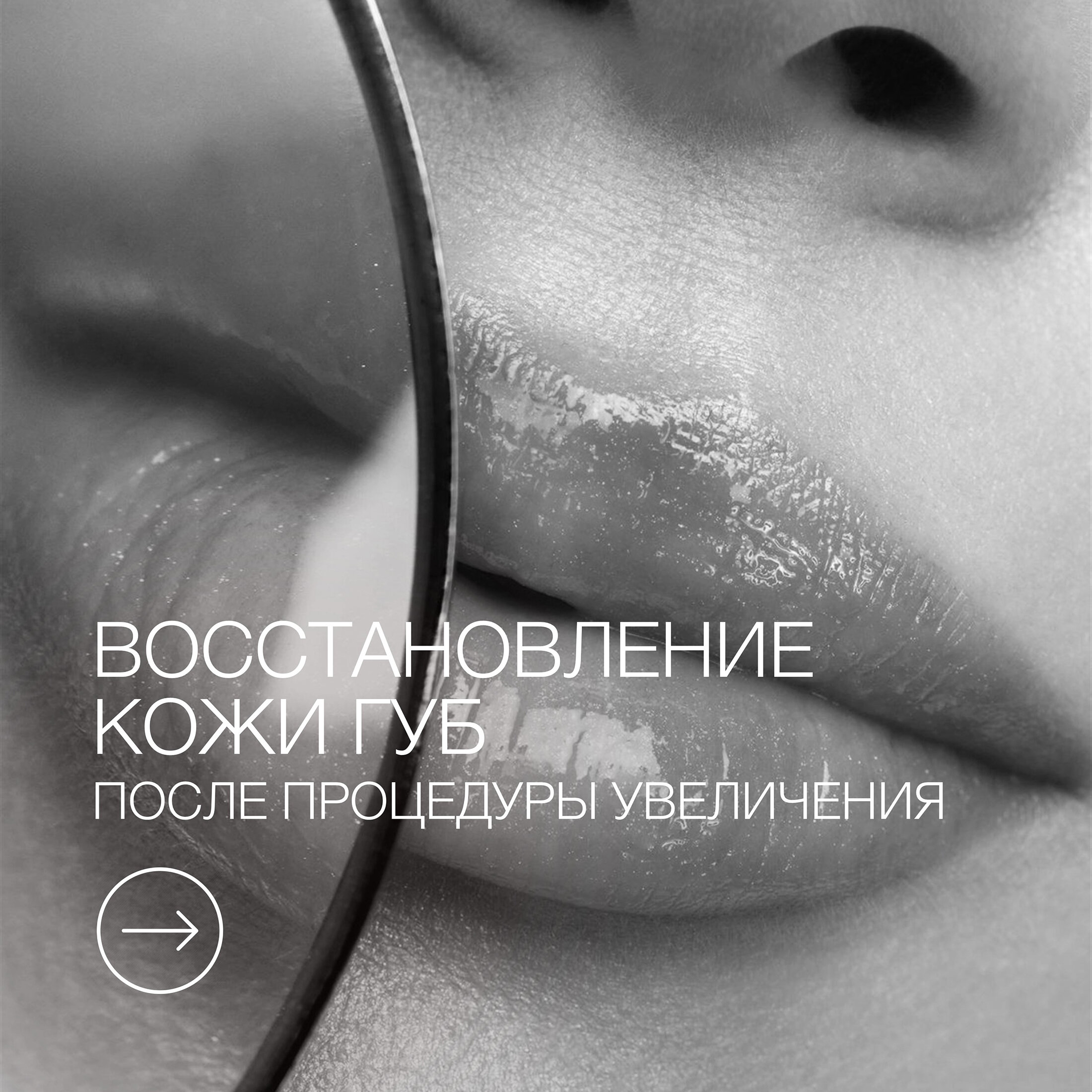 Пост увеличение губ 2.jpg Пост увеличение губ 2.jpg